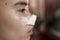 Side view of a female patient fresh from a rhinoplasty procedure. Nose covered with bandage