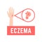 Sign of eczema-affected hand