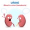 Sign and symptom of kidney disease, bad health. Blood color urine or hematuria