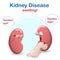 Sign and symptom of kidney disease, bad health. Swollen of leg and eye, this sign of a kidney problem.