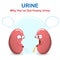 Sign and symptom of kidney disease, bad health. Urine has many Foamy or bubble, this sign of a kidney problem.