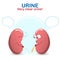 Sign and symptom of kidney disease, bad health. Urine is very clear, this sign of a kidney problem