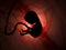 Silhouette of a human embryo on ultrasound examination in the womb during pregnancy. A baby with an umbilical cord