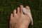 Silicone Bunion Regulator, Bunion on left foot of an adult white woman on astro turf. Toe nails are not painted.