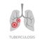 Simple, flat illustration of a lung disease. Pneumonia infographics, drawing for informational, medical poster