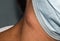 Single swelling or lymph node at the neck