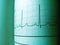 Sinus Heart Rhythm On Electrocardiogram Record Paper