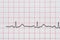 Sinus Heart Rhythm On Electrocardiogram Record Paper Showing Normal Heart