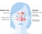 Sinusitis, vector illustration_1