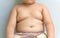 The size of stomach of children with overweight.