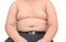 The size of stomach of children with overweight isolated.