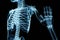 Skeletal Insight: X-ray Reveals the Intricate Structure of the Human Skeleton