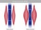 Skeletal Muscle pump effect. Illustration of muscle pump effect on venous return and muscle blood. Calf Muscles