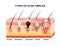 Skin Acne Anatomy Composition