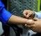 skin allergy test preparation by doctor on a patient hand using lancet to the skin