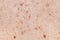 Skin background texture with pimples and blackheads. problematic skin close up. acne diseases