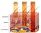 Skin burn classification