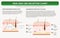 Skin and CBD Receptor Chart horizontal textbook infographic