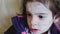 Skin condition forehead child antihistamine ointment face chickenpox