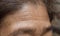 Skin creases or wrinkles at oily forehead of Myanmar or Burmese elder woman. Symptom of aging