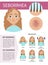 Skin disease infographic