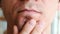 Skin irritation after shaving. Man`s hands squeeze pimples on the chin. Closeup chin, lips.