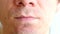 Skin irritation after shaving. Pimples on the man`s chin. Closeup nose, lips and chin.