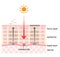 Skin mechanism of blotches