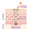 Skin mechanism of melanin and facial dark spots. Infographic human skin layer illustration. Beauty and skin care concept