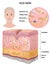 The skin of an old woman, wrinkles, detailed illustration, medicine, vector