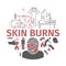 Skinl Burns kine banner. Treatment. Vector illustrations