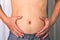 Skinny man with belly fat pulled have pulled their abdominal muscle