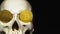 Skull with US Dollar bills in his mouth, bitcoins on the eyes. dark background