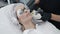 Slow motion cosmetologist makes girl procedure for healing skin of face with special device
