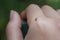 A small Aedes mosquito on the back of the hand. mosquito s of dengue fever.
