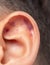 Small bruises on the ear
