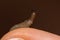 Small slug on finger