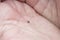 A small tick pulled from the host`s skin lies on the hand of the veterinarian. A tick extracted from the skin of a cat lies on a h