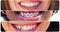 Smile, happy and closeup of mouth of women in city for happiness, joy and facial expression. Diversity, dental and