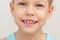 Smiling child face cropped head caucasian little girl of 6 7 years