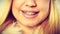 Smiling girl with dental braces closeup