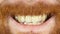 Smiling Lips, Close up of Red Hair Beard Man