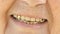 Smiling mouth of old woman with false teeth