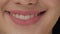 Smiling woman mouth with great white teeth close up