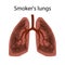 Smoker`s lungs. Damage to the lungs of a person caused by smoking.
