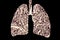 Smoker`s lungs, medical concept, 3D illustration, Lung disease conceptual image