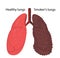 Smokers lungs and healthy lungs