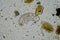 soil microorganisms including nematode, microarthropods, micro arthropod, tardigrade, and rotifers a soil sample, soil fungus and