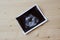 Sonogram on Wood Background