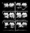 Sonography upper abdomen medical examination.